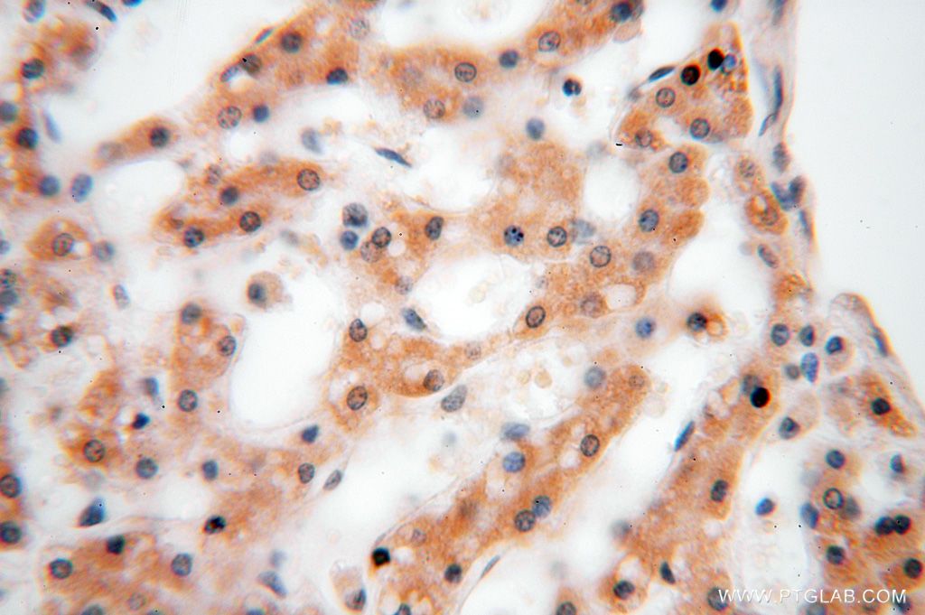 Immunohistochemistry (IHC) staining of human liver tissue using GALNT14 Polyclonal antibody (16939-1-AP)