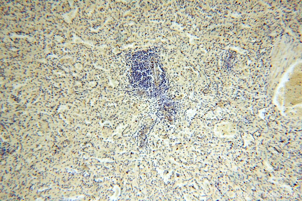 IHC staining of human spleen using 16939-1-AP