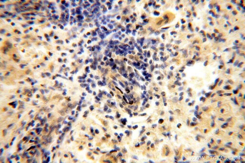 Immunohistochemistry (IHC) staining of human spleen tissue using GALNT14 Polyclonal antibody (16939-1-AP)