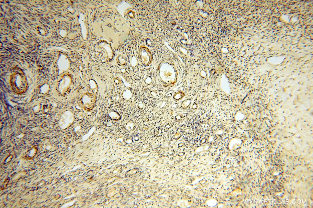 Immunohistochemistry (IHC) staining of human ovary tissue using GALNT14 Polyclonal antibody (16939-1-AP)