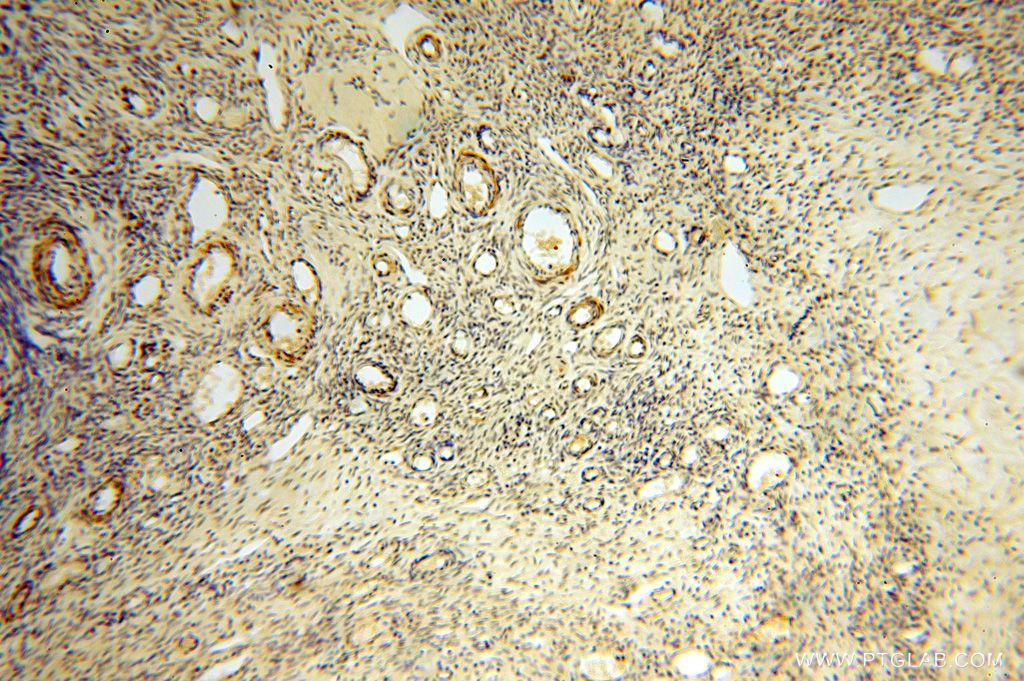 IHC staining of human ovary using 16939-1-AP