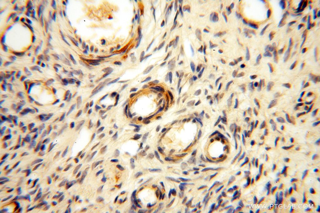 Immunohistochemistry (IHC) staining of human ovary tissue using GALNT14 Polyclonal antibody (16939-1-AP)