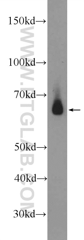Western Blot (WB) analysis of rat testis tissue using GALNT14 Polyclonal antibody (16939-1-AP)
