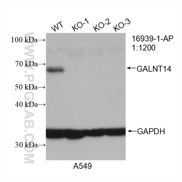 Western Blot (WB) analysis of A549 cells using GALNT14 Polyclonal antibody (16939-1-AP)