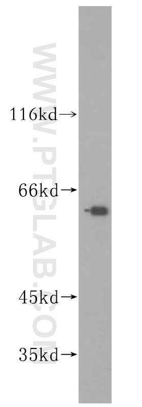 Western Blot (WB) analysis of mouse testis tissue using GALNT14 Polyclonal antibody (16939-1-AP)