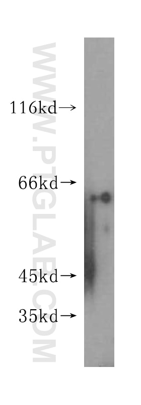 Western Blot (WB) analysis of mouse kidney tissue using GALNT14 Polyclonal antibody (16939-1-AP)