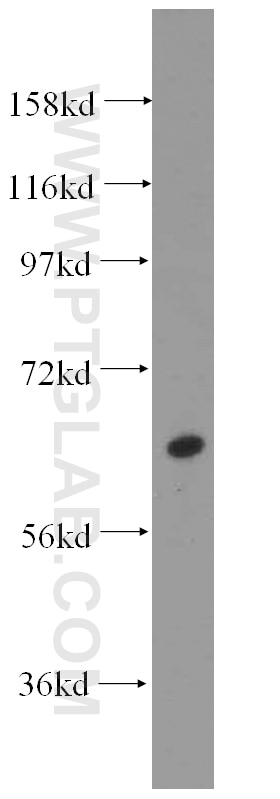 Western Blot (WB) analysis of mouse lung tissue using GALNT14 Polyclonal antibody (16939-1-AP)