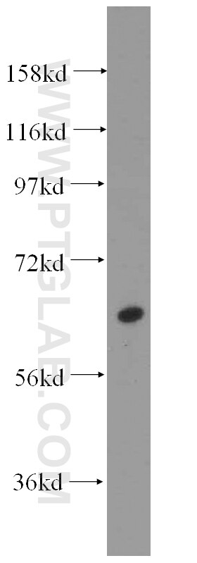 WB analysis of mouse lung using 16939-1-AP