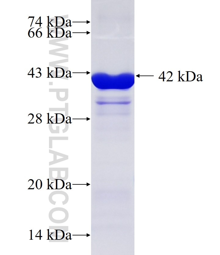 GALNT14 fusion protein Ag10470 SDS-PAGE