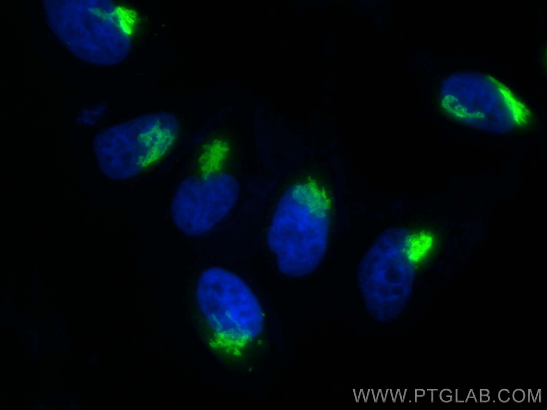 Immunofluorescence (IF) / fluorescent staining of HeLa cells using GALNT2 Polyclonal antibody (17441-1-AP)