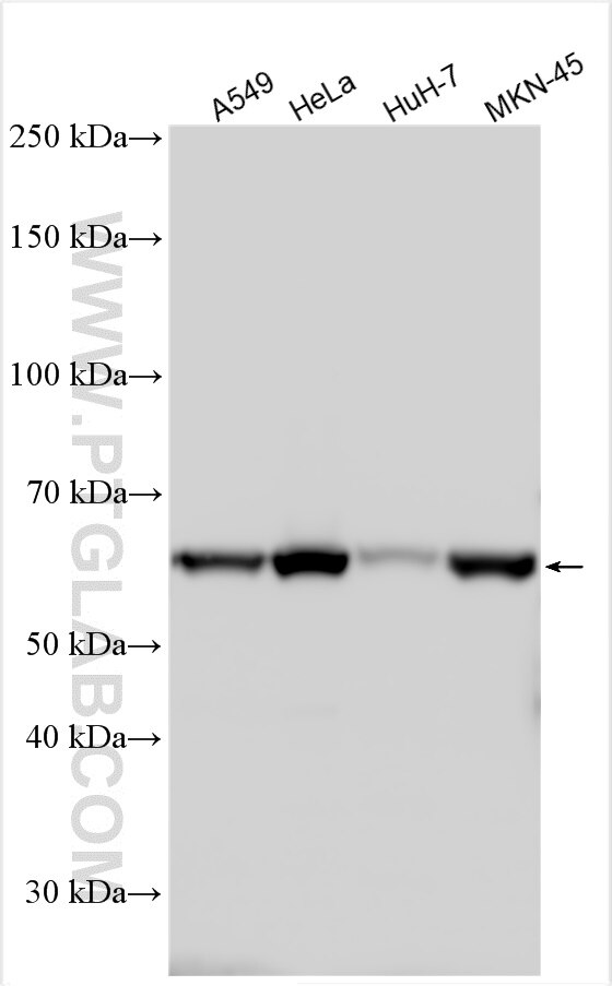 Western Blot (WB) analysis of various lysates using GALNT2 Polyclonal antibody (17441-1-AP)