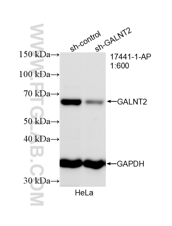 Western Blot (WB) analysis of HeLa cells using GALNT2 Polyclonal antibody (17441-1-AP)