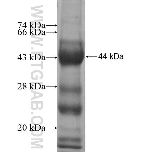 GALNT2 fusion protein Ag11562 SDS-PAGE GALNT2 fusion protein Ag11562 SDS-PAGE