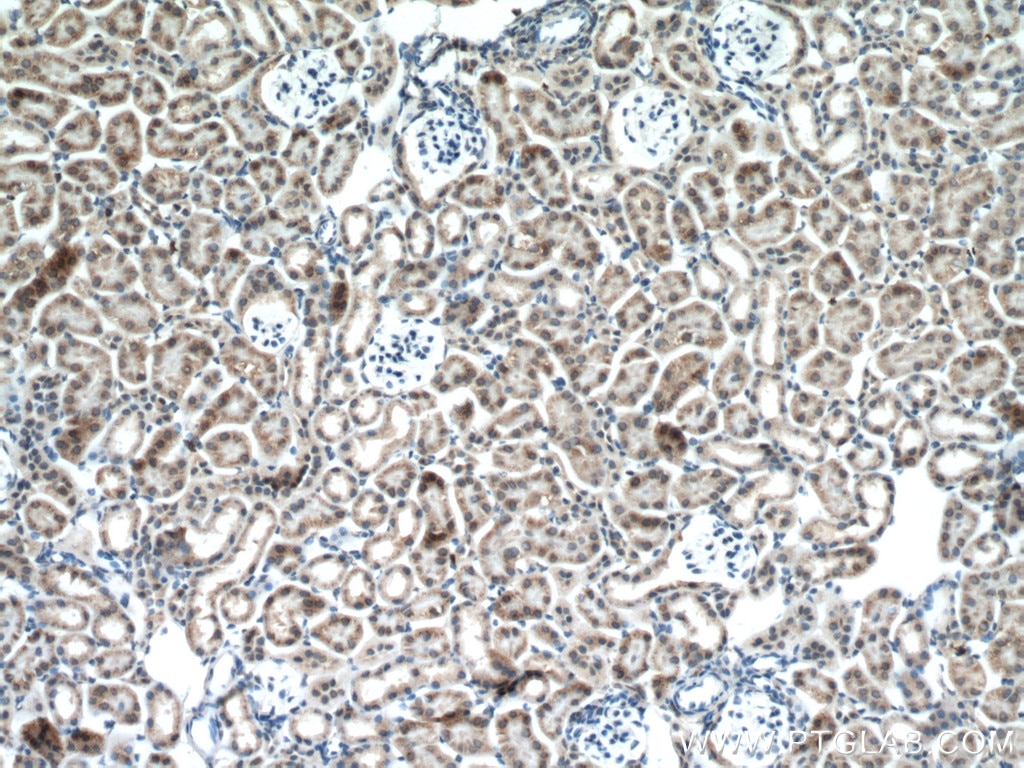 Immunohistochemistry (IHC) staining of mouse kidney tissue using GALNT3 Polyclonal antibody (16716-1-AP)