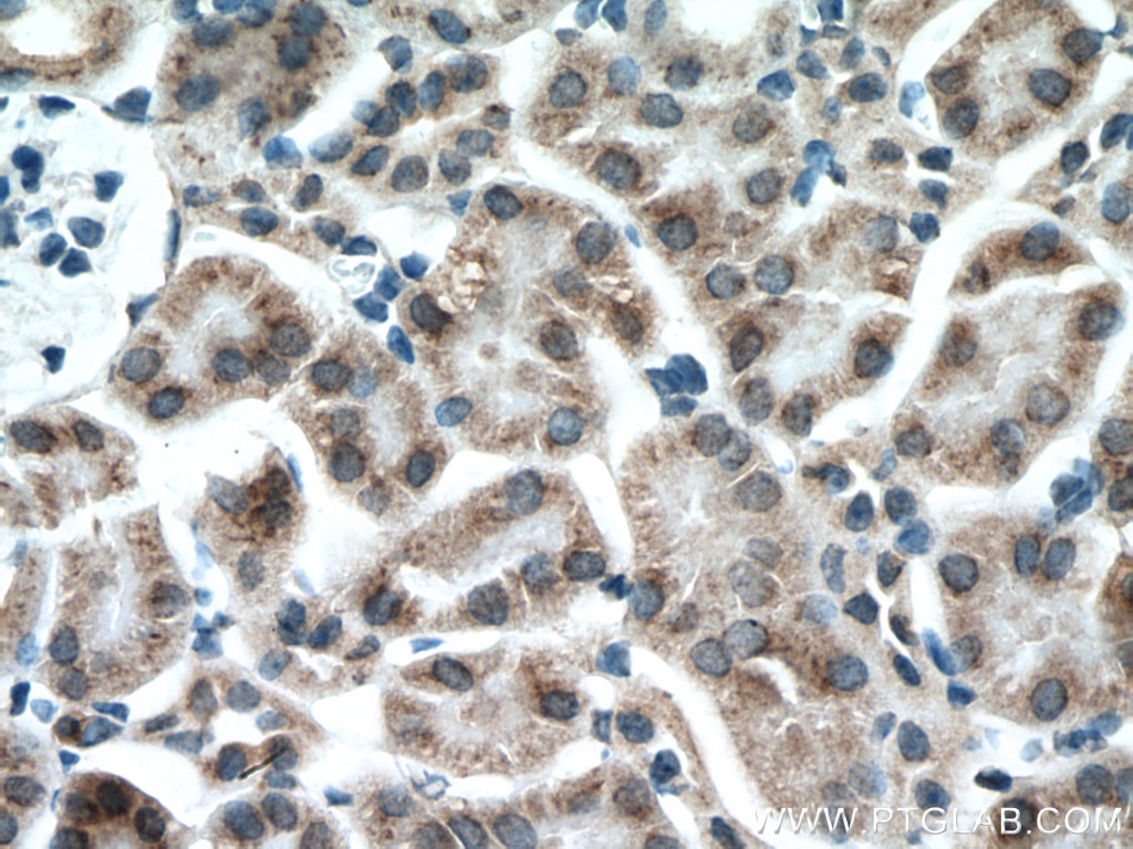 Immunohistochemistry (IHC) staining of mouse kidney tissue using GALNT3 Polyclonal antibody (16716-1-AP)