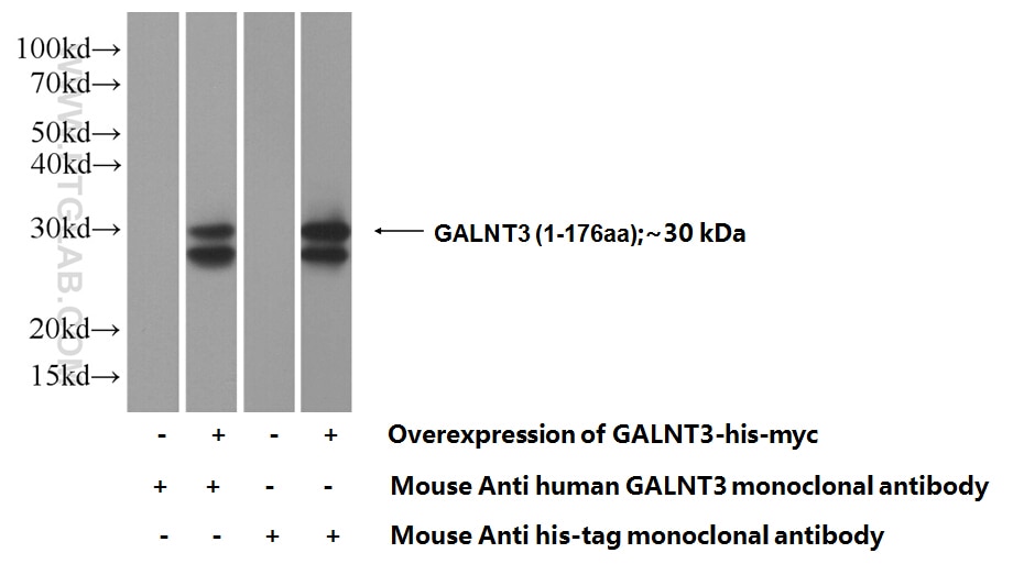 Western Blot (WB) analysis of Transfected HEK-293 cells using GALNT3 Polyclonal antibody (16716-1-AP)
