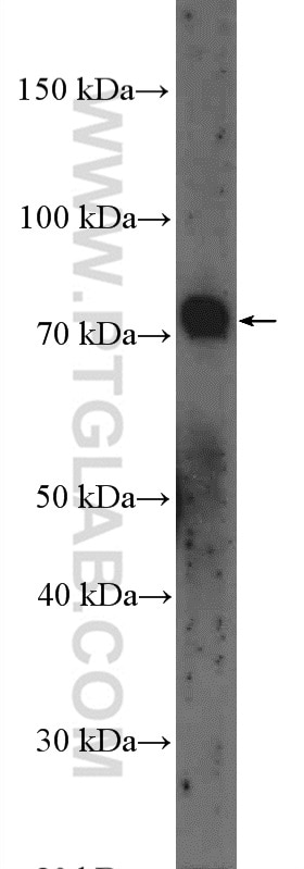 Western Blot (WB) analysis of PC-3 cells using GALNT3 Polyclonal antibody (16716-1-AP)