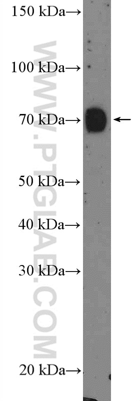 Western Blot (WB) analysis of mouse testis tissue using GALNT3 Polyclonal antibody (16716-1-AP)