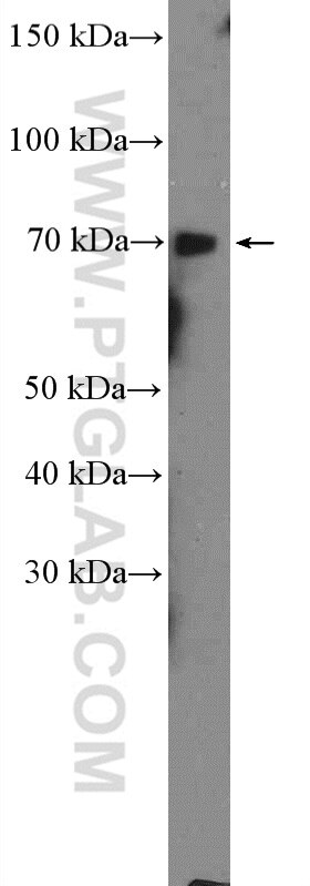 Western Blot (WB) analysis of DU 145 cells using GALNT3 Polyclonal antibody (16716-1-AP)