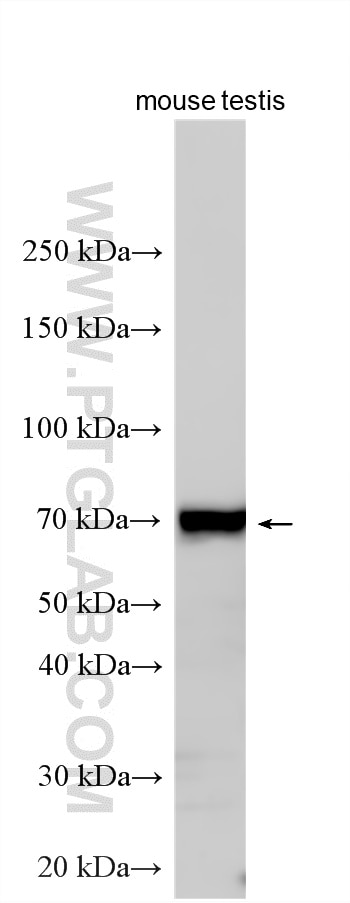 Western Blot (WB) analysis of various lysates using GALNT3 Polyclonal antibody (16716-1-AP)