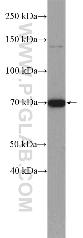 Western Blot (WB) analysis of HeLa cells using GALNT3 Polyclonal antibody (16716-1-AP)