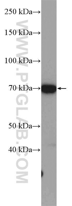 Western Blot (WB) analysis of mouse liver tissue using GALNT3 Polyclonal antibody (16716-1-AP)