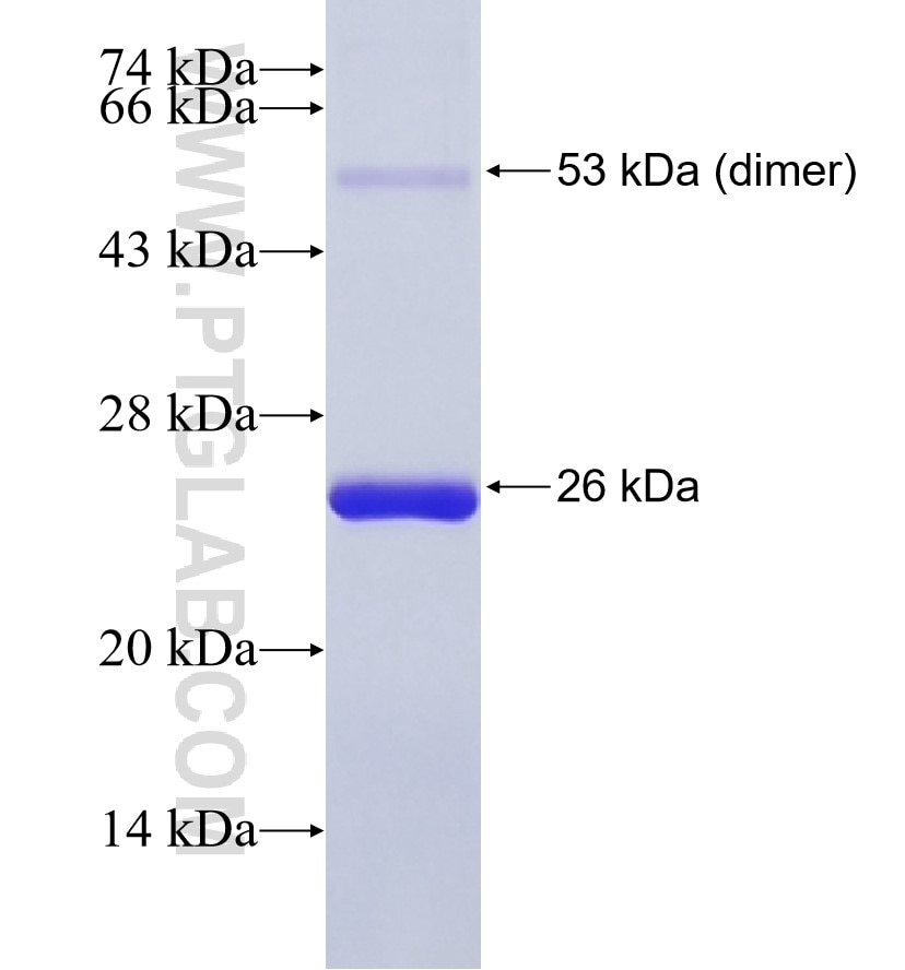 GALNT3 fusion protein Ag9941 SDS-PAGE