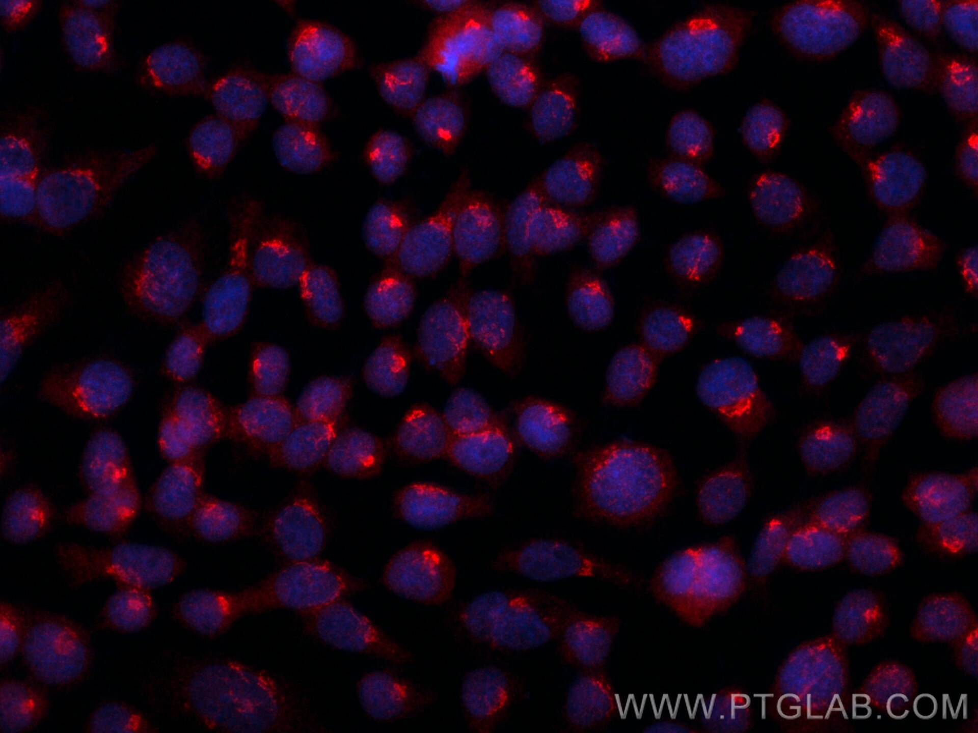 Immunofluorescence (IF) / fluorescent staining of A431 cells using GALNT6 Polyclonal antibody (13671-1-AP)