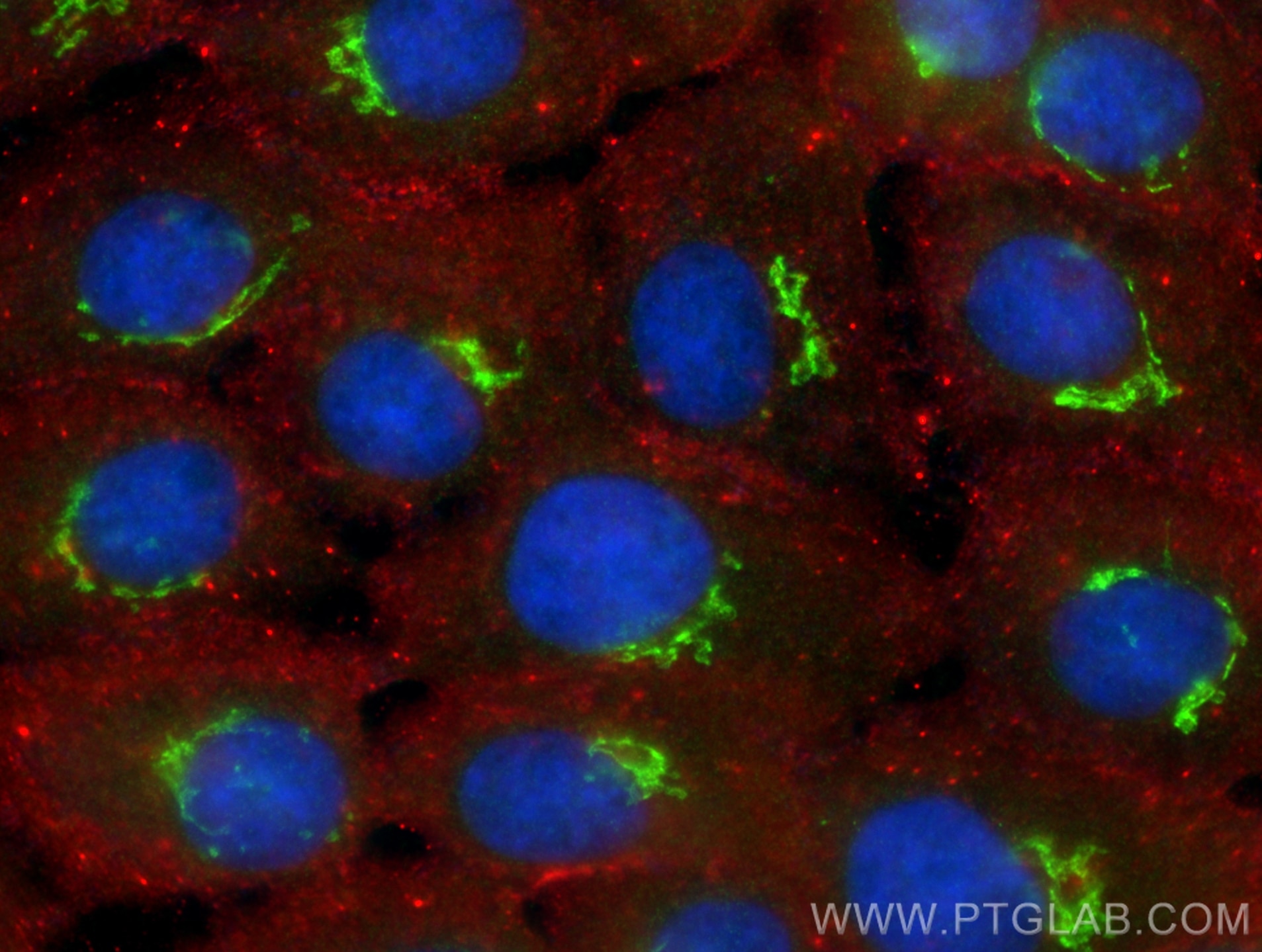 Immunofluorescence (IF) / fluorescent staining of A431 cells using GALNT6 Polyclonal antibody (13671-1-AP)