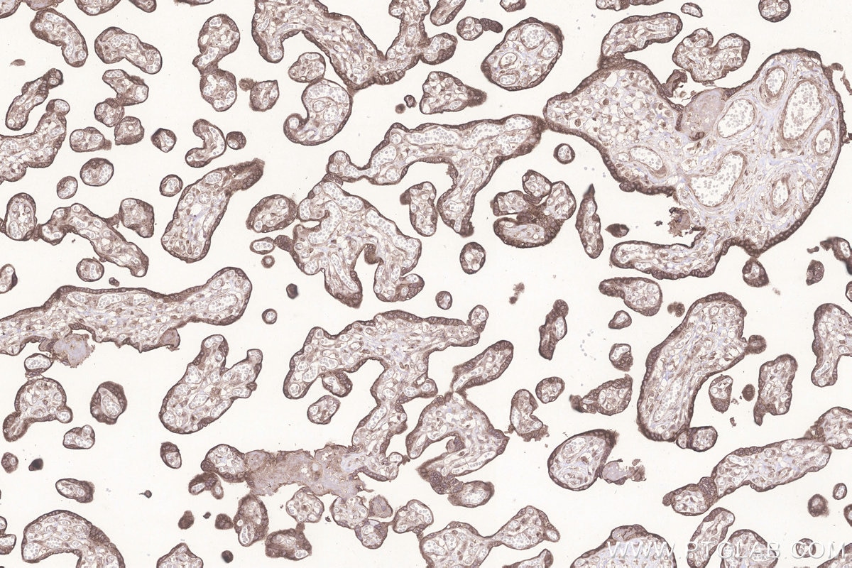 IHC staining of human placenta using 13671-1-AP Immunohistochemistry (IHC) staining of human placenta tissue using GALNT6 Polyclonal antibody (13671-1-AP)