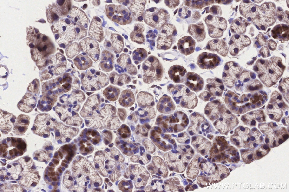 Immunohistochemistry (IHC) staining of mouse salivary gland tissue using GALNT6 Polyclonal antibody (13671-1-AP)