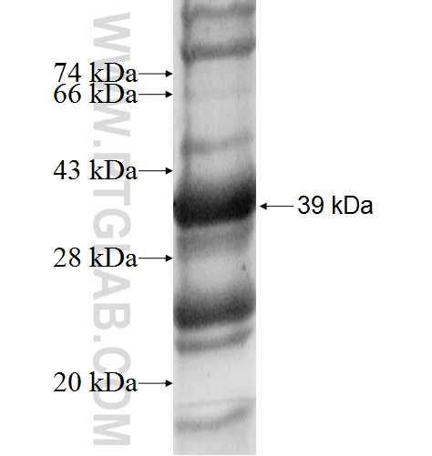 GALNT6 fusion protein Ag6949 SDS-PAGE