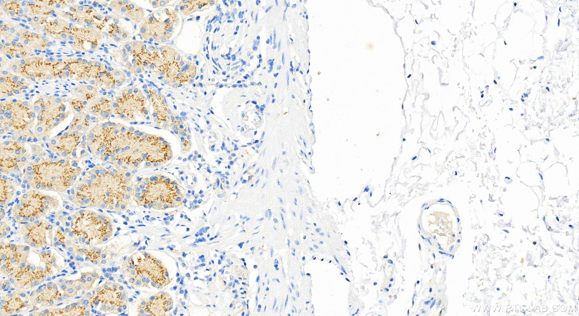 Immunohistochemistry (IHC) staining of human stomach tissue using GALNT7 Polyclonal antibody (13962-1-AP)
