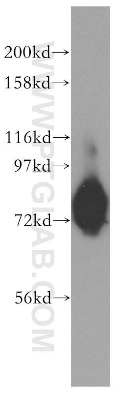 Western Blot (WB) analysis of HepG2 cells using GALNT7 Polyclonal antibody (13962-1-AP)