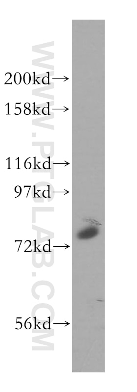 Western Blot (WB) analysis of HeLa cells using GALNT7 Polyclonal antibody (13962-1-AP)