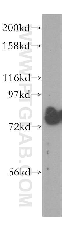 Western Blot (WB) analysis of human brain tissue using GALNT7 Polyclonal antibody (13962-1-AP)