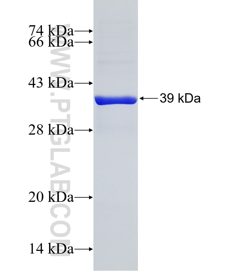 GALNT8 fusion protein Ag21176 SDS-PAGE