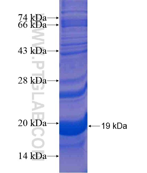 GALNT8 fusion protein Ag21185 SDS-PAGE