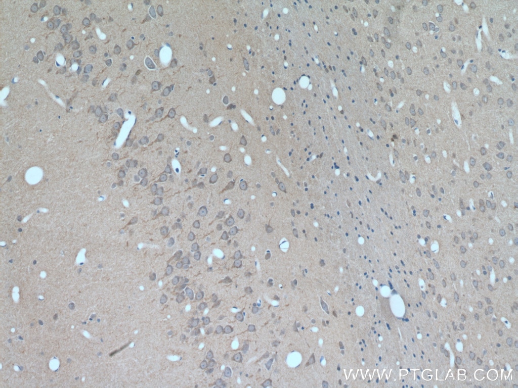 Immunohistochemistry (IHC) staining of rat brain tissue using GALNT9 Polyclonal antibody (25967-1-AP)