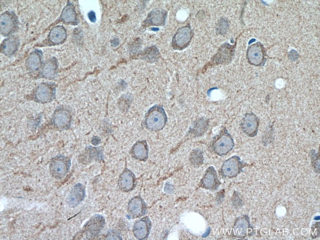 Immunohistochemistry (IHC) staining of rat brain tissue using GALNT9 Polyclonal antibody (25967-1-AP)