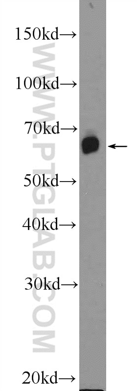 Western Blot (WB) analysis of mouse brain tissue using GALNT9 Polyclonal antibody (25967-1-AP)