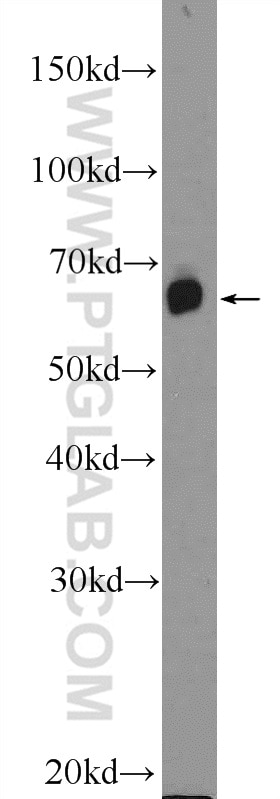 WB analysis of mouse brain using 25967-1-AP