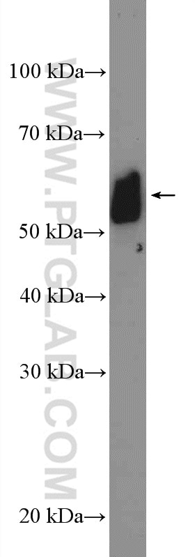 Western Blot (WB) analysis of C6 cells using GALNT9 Polyclonal antibody (25967-1-AP)
