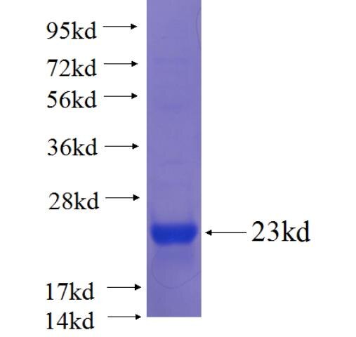 GALNT9 fusion protein Ag23233 SDS-PAGE