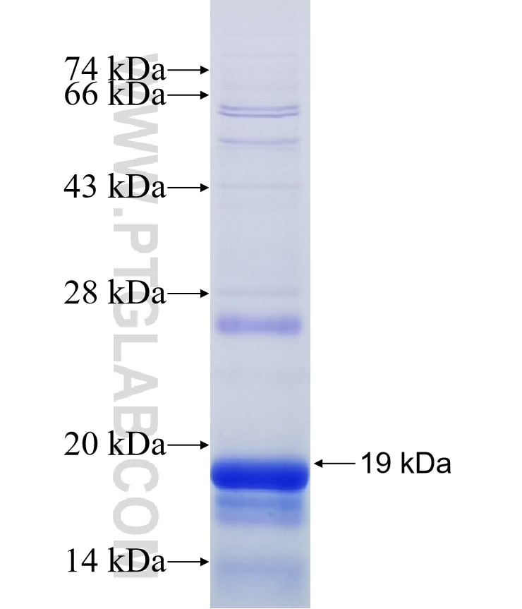 GALNTL1 fusion protein Ag15776 SDS-PAGE