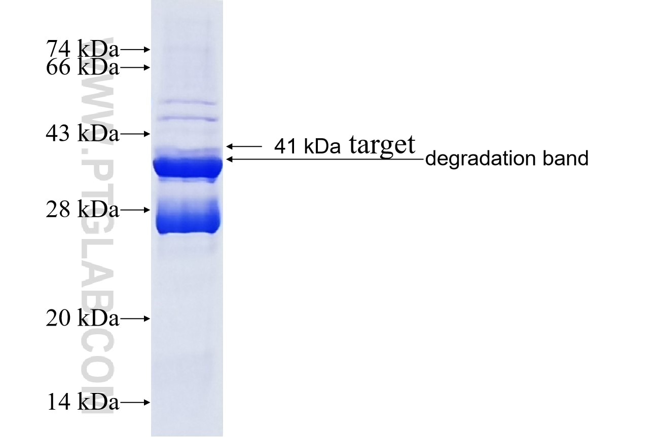 GALNTL1 fusion protein Ag16197 SDS-PAGE GALNTL1 fusion protein Ag16197 SDS-PAGE