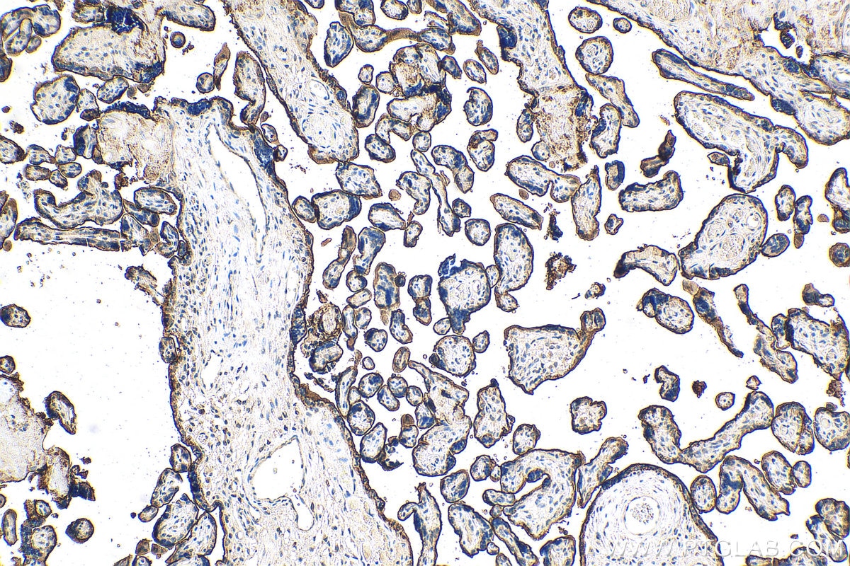 Immunohistochemistry (IHC) staining of human placenta tissue using GALNTL2 Polyclonal antibody (16900-1-AP)