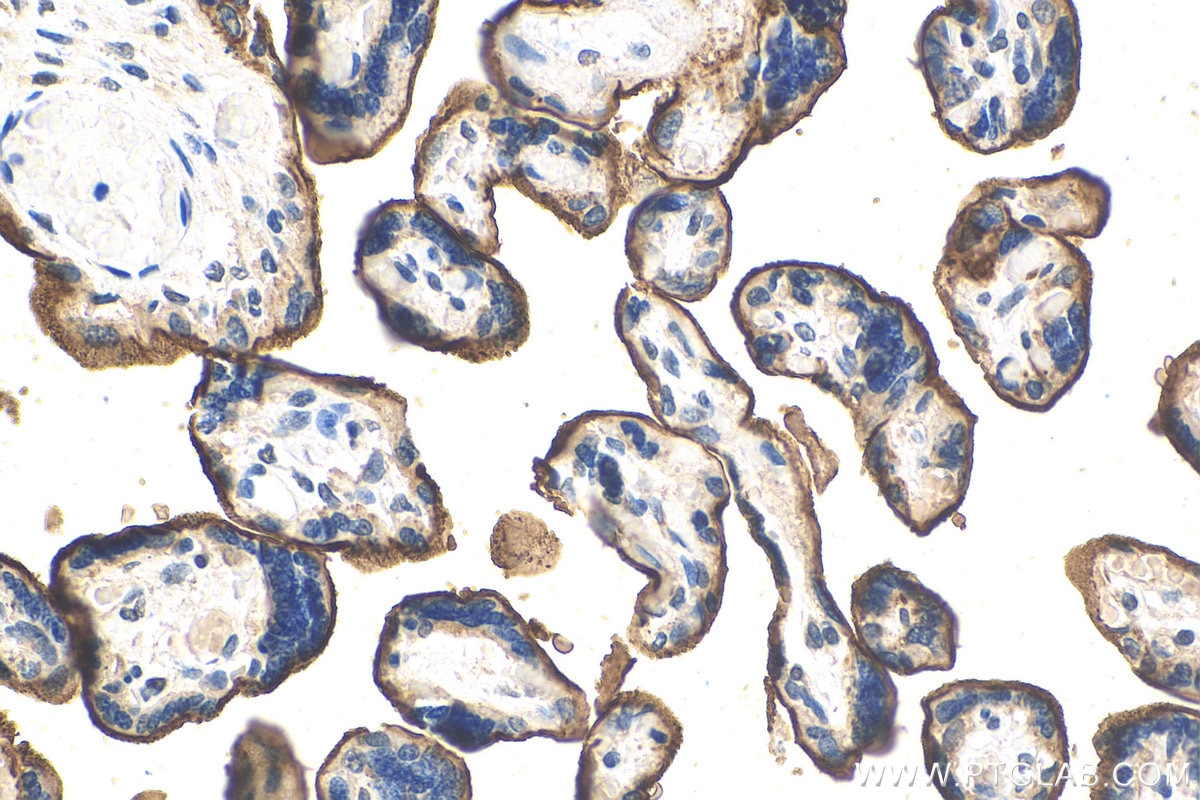 Immunohistochemistry (IHC) staining of human placenta tissue using GALNTL2 Polyclonal antibody (16900-1-AP)