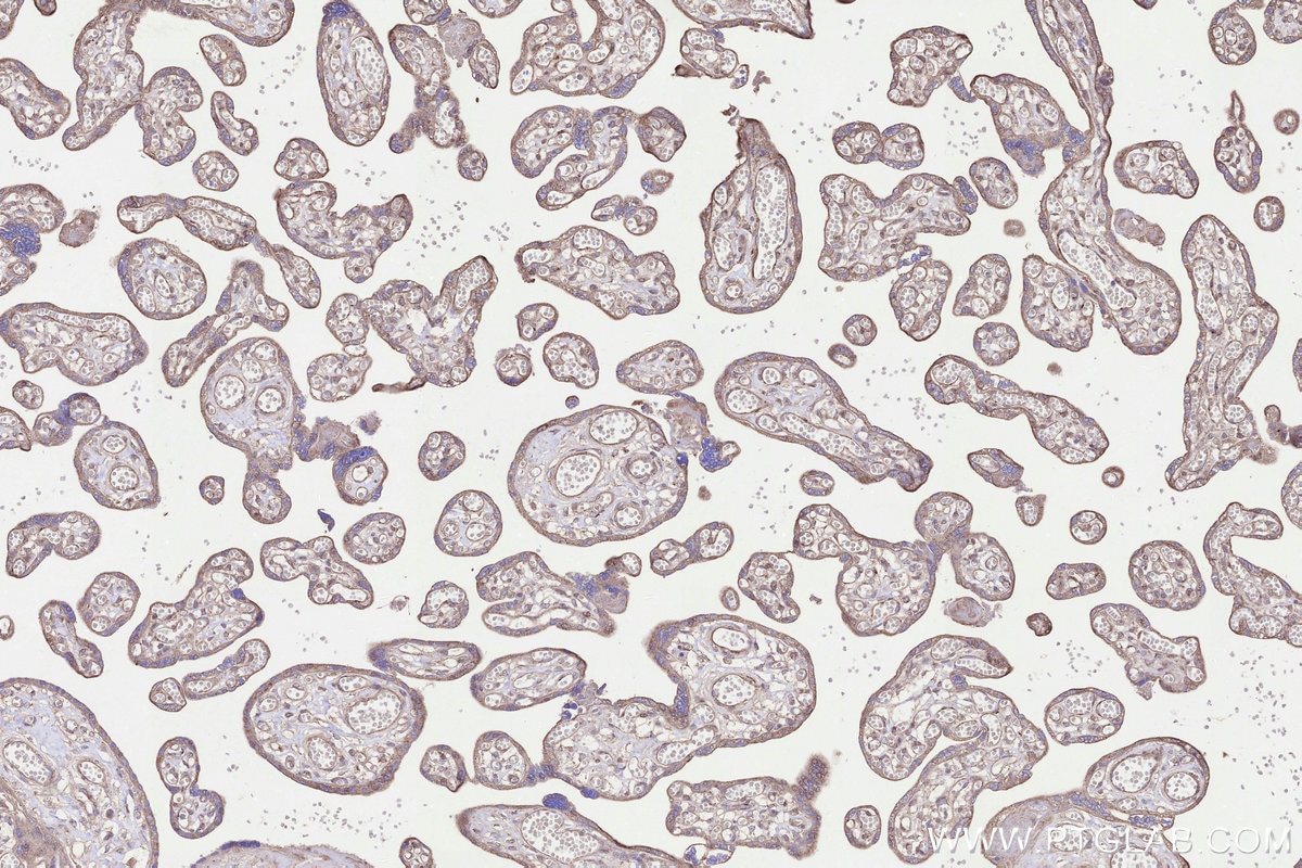 Immunohistochemistry (IHC) staining of human placenta tissue using GALNTL2 Polyclonal antibody (16900-1-AP)