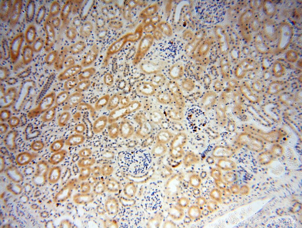 Immunohistochemistry (IHC) staining of human kidney tissue using GALNTL2 Polyclonal antibody (16900-1-AP)